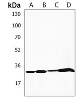HLA-DRB1 Rabbit Polyclonal Antibody