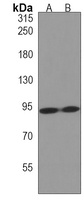 ZNF560 Rabbit Polyclonal Antibody