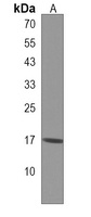 RPL29 Rabbit Polyclonal Antibody