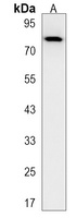 TPX2 Rabbit Polyclonal Antibody