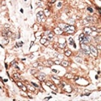 TPX2 Rabbit Polyclonal Antibody