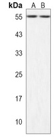 ZSCAN32 Rabbit Polyclonal Antibody