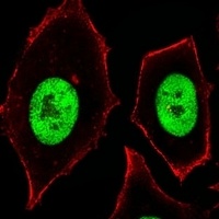 ZSCAN32 Rabbit Polyclonal Antibody