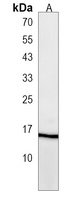 FUNDC2 Rabbit Polyclonal Antibody