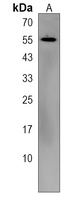 KRT86 Rabbit Polyclonal Antibody