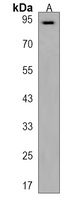 PDE8B Rabbit Polyclonal Antibody
