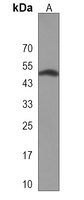 CASQ2 Rabbit Polyclonal Antibody
