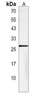 PDAP1 Rabbit Polyclonal Antibody
