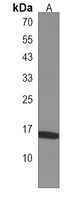 HIST2H3A Rabbit Polyclonal Antibody