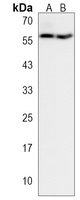 TMX3 Rabbit Polyclonal Antibody