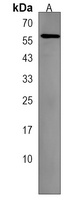 LGI3 Rabbit Polyclonal Antibody