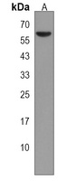 LRRTM2 Rabbit Polyclonal Antibody