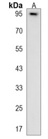 ELFN1 Rabbit Polyclonal Antibody