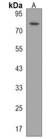 HECTD2 Rabbit Polyclonal Antibody