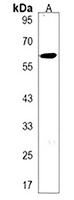 TRPC4AP Rabbit Polyclonal Antibody