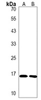 EMP3 Rabbit Polyclonal Antibody
