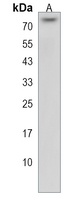 ZNF416 Rabbit Polyclonal Antibody