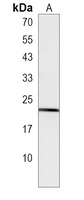 TAGLN3 Rabbit Polyclonal Antibody