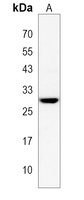 LIPT2 Rabbit Polyclonal Antibody