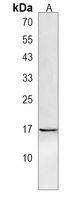 GLIPR2 Rabbit Polyclonal Antibody