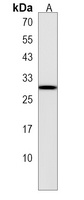 STXBP6 Rabbit Polyclonal Antibody