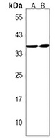 RQCD1 Rabbit Polyclonal Antibody