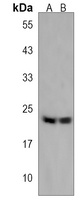 LZIC Rabbit Polyclonal Antibody
