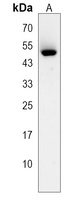 Kir2.2 Rabbit Polyclonal Antibody