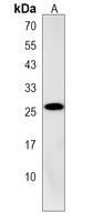 AIDA Rabbit Polyclonal Antibody