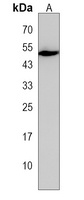 IKBIP Rabbit Polyclonal Antibody