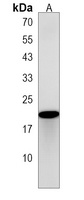 DNAJC5G Rabbit Polyclonal Antibody