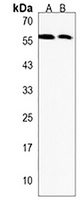 CRLF3 Rabbit Polyclonal Antibody