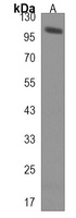 HECTD3 Rabbit Polyclonal Antibody