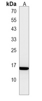 EMP1 Rabbit Polyclonal Antibody