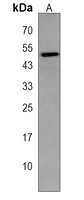 CRLF1 Rabbit Polyclonal Antibody