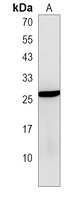 PTTG2 Rabbit Polyclonal Antibody