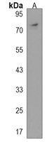 PHEX Rabbit Polyclonal Antibody