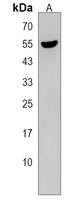 TTC8 Rabbit Polyclonal Antibody