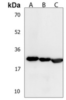LY6G6F Rabbit Polyclonal Antibody