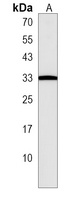 PTPRCAP Rabbit Polyclonal Antibody