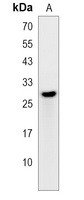 PCTP Rabbit Polyclonal Antibody