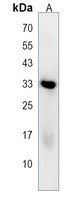 PLEKHF1 Rabbit Polyclonal Antibody
