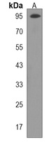 GNL2 Rabbit Polyclonal Antibody