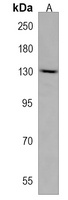 PDS5A Rabbit Polyclonal Antibody
