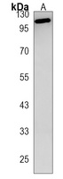 PKD2L1 Rabbit Polyclonal Antibody