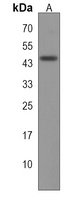 HSDL2 Rabbit Polyclonal Antibody