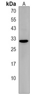 ZDHHC3 Rabbit Polyclonal Antibody