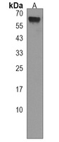 VPS45 Rabbit Polyclonal Antibody