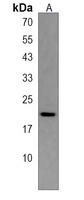 TTC33 Rabbit Polyclonal Antibody