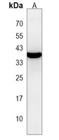 mPR beta Rabbit Polyclonal Antibody